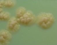mycobacterium mycobacterium colony
